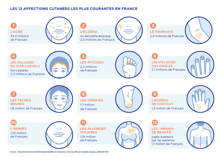 Semaine Nationale De Dépistage Du Cancer De La Peau Leem 5398